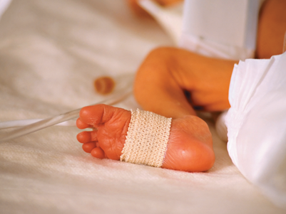 Congres passende zorg bij (dreigende) vroeggeboorte